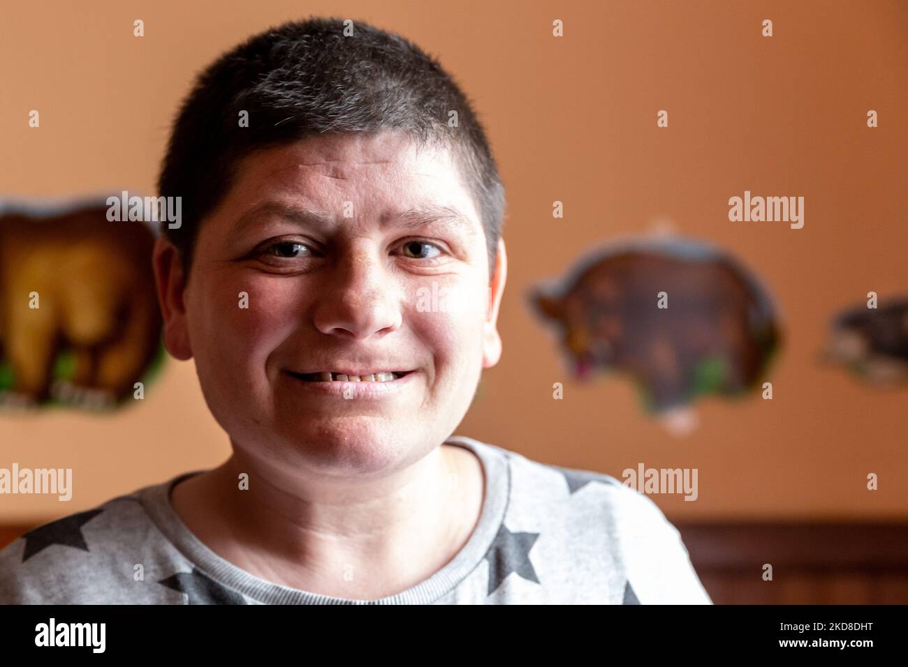 A young Ukrainian woman with learning disabilities smiles as she rests in a common room in a Center for women and girls with learning disabilities run by Greek Catholic church in Bukova, Lviv Oblast Ukraine on April 25, 2022. As the Russian Federation invaded Ukraine two months ago, the conflict caused that places like the Centre in Bukova become even more isolated and underfunded. (Photo by Dominika Zarzycka/NurPhoto) Stock Photo
