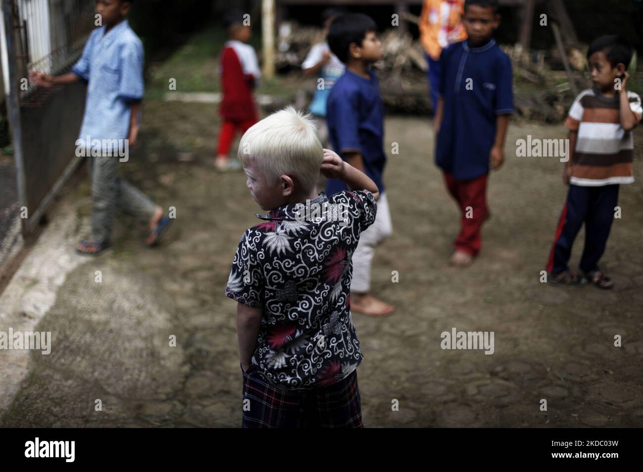 Lukman Nurhakim (7), one of the decendant of Albino, playing wih