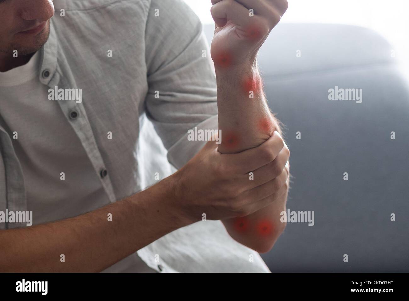 People scratch the itch with hand. Allergic rash dermatitis eczema skin of patient Stock Photo