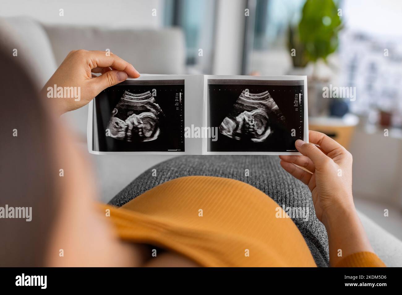 Pregnant woman looking at first ultrasound photo of her baby, caressing her belly happily awaiting the birth of her child. First trimester pregnancy Stock Photo