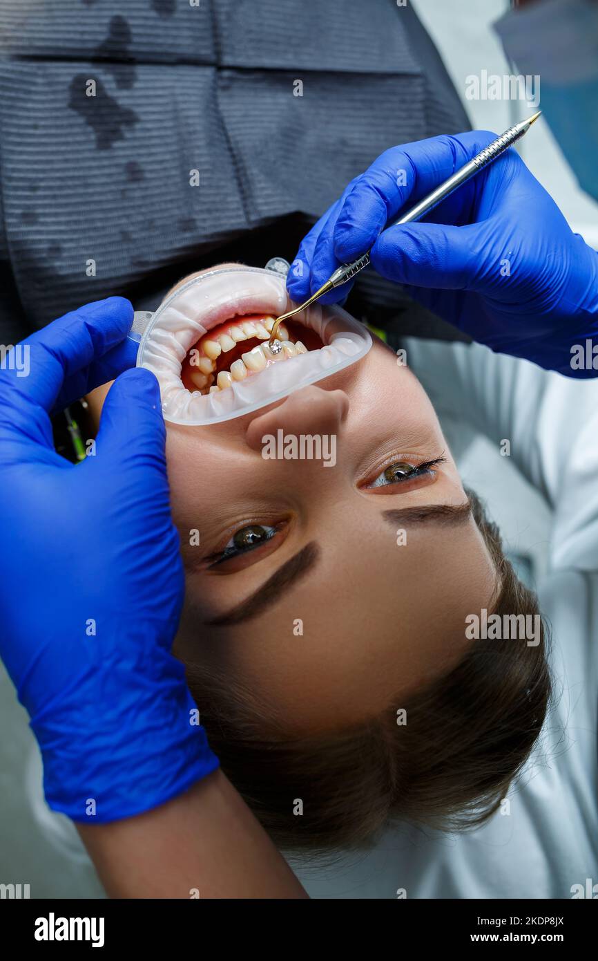 The orthodontist puts metal braces on the patient's teeth. Orthodontic ...