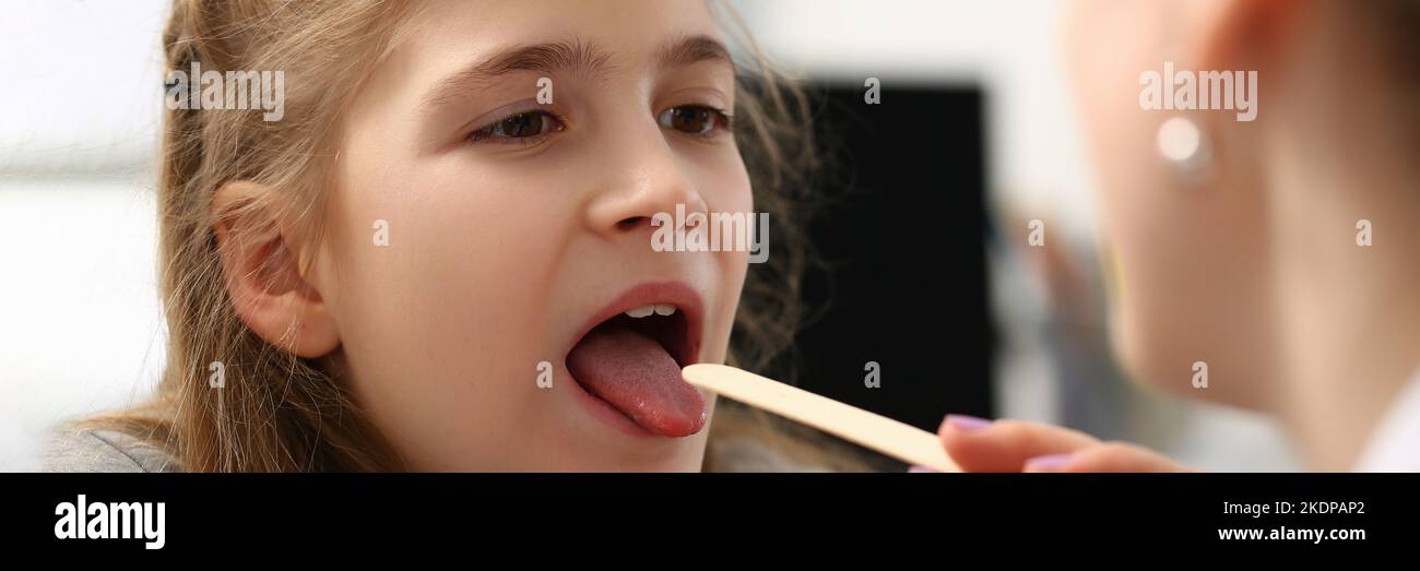 Pediatrician checking girls hurting throat with stick Stock Photo