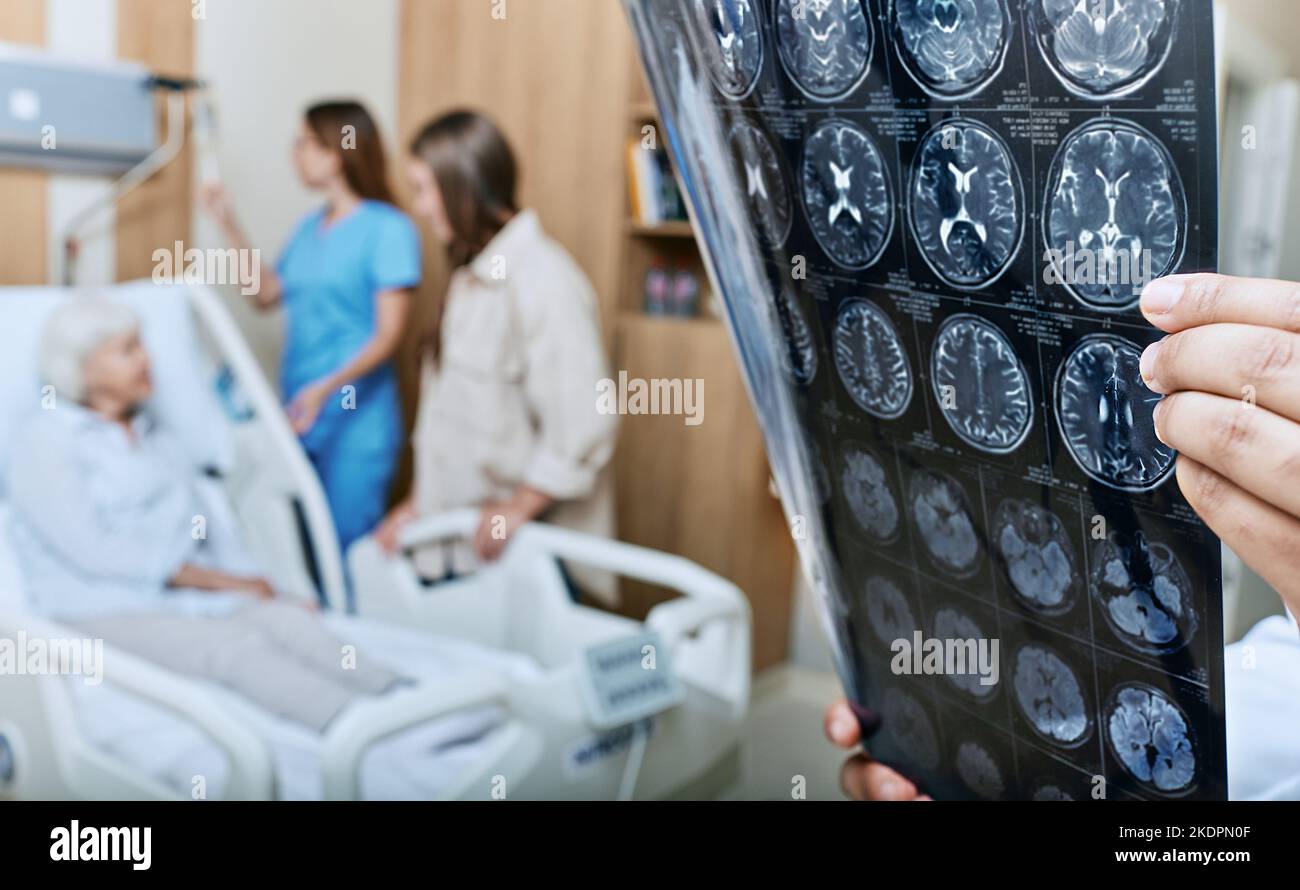 MRI of head of elderly woman in hands of doctor standing in medical ward near senior patient with relative and nurse. Recovery after a stroke Stock Photo