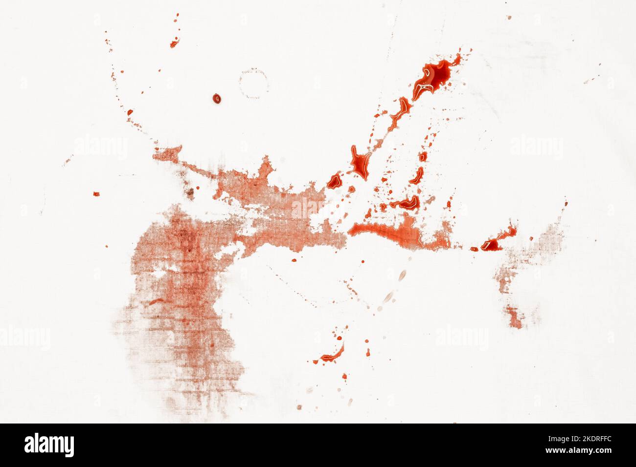 Arterial Blood Spray arterial-blood-spray