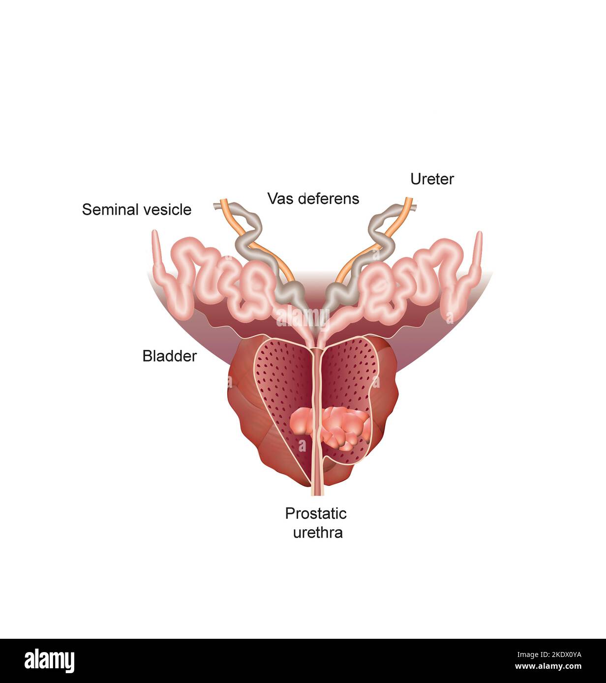 Prostate Cancer Backround Prostate cancer, illustration Stock Photo - Alamy