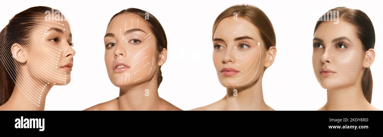 Collage. Portraits of young beautiful woman with lifting arrows on face. Cosmetological injections Stock Photo