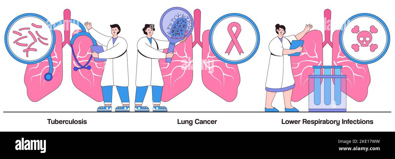 Tuberculosis, lung cancer, lower respiratory infections concepts with people characters. Lung disease illustration pack. Symptoms and diagnostics, onc Stock Vector