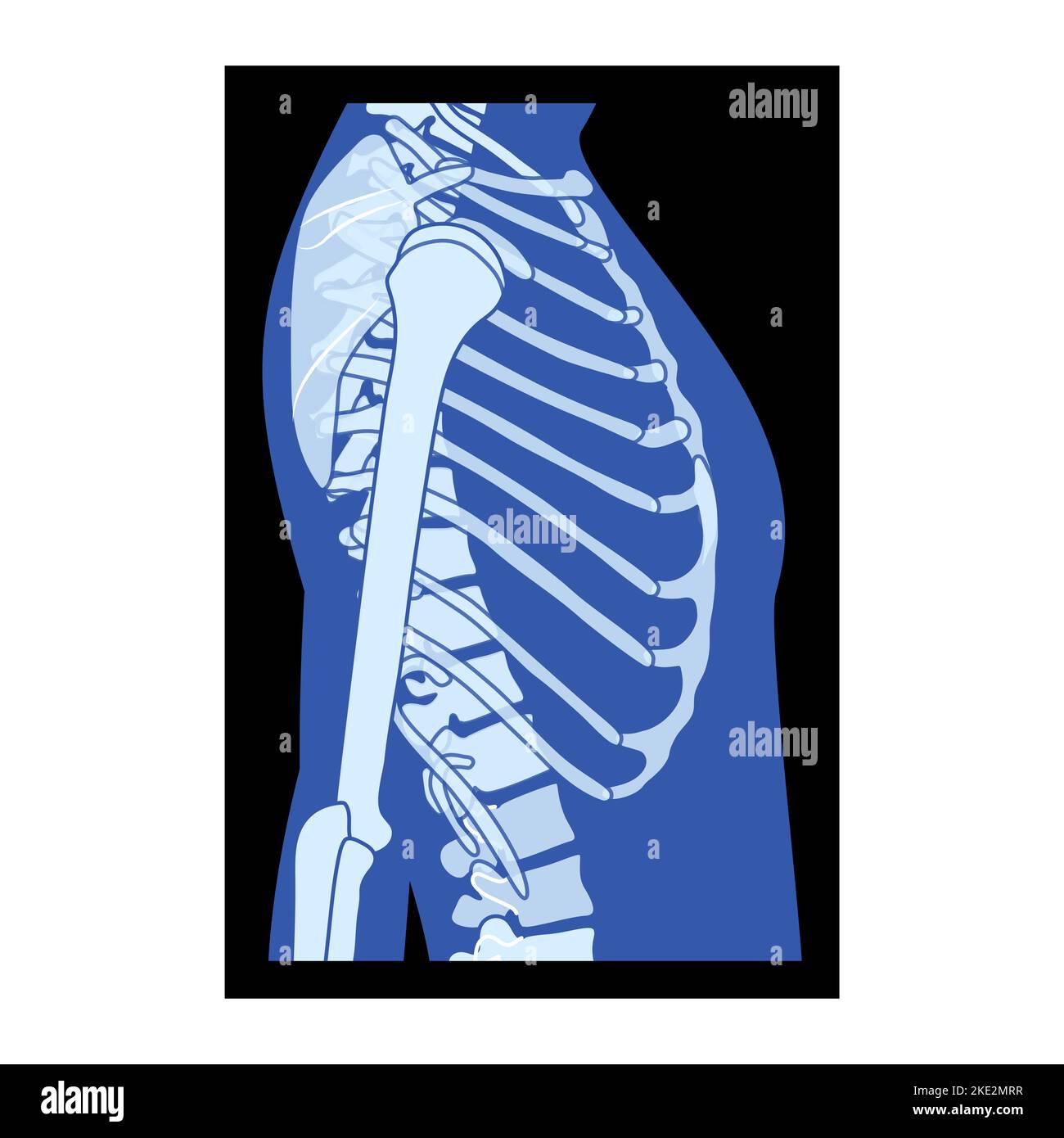 X-Ray rib cage and hands Skeleton Human body Bones adult people roentgen side view. 3D realistic flat blue color concept Vector illustration of medical anatomy isolated on black background Stock Vector