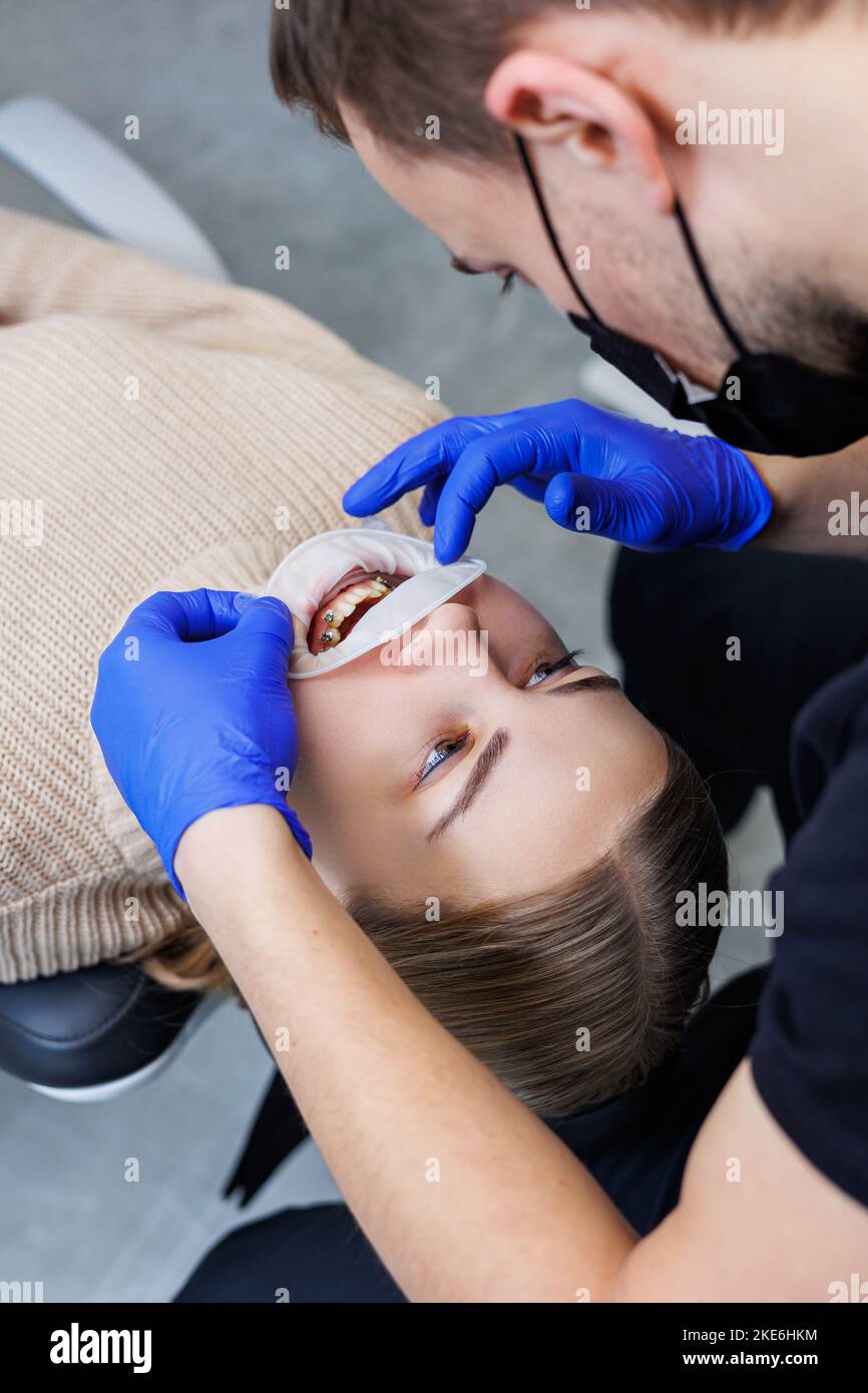 Woman teeth with braces on white teeth. An orthodontist uses dental ...
