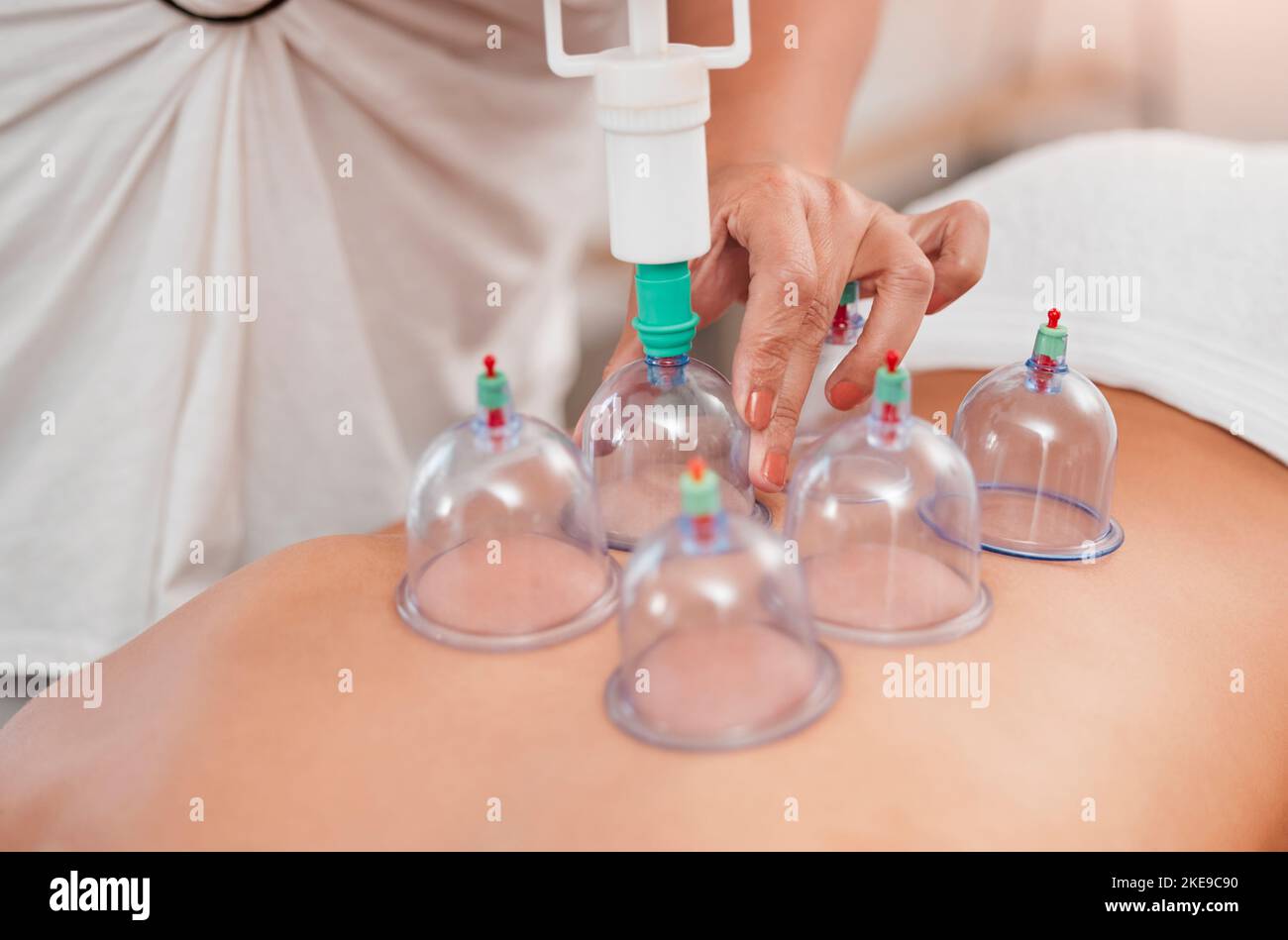 Spa, physiotherapy and cupping therapy with back of woman for relax, massage and beauty. Health, alternative medicine and holistic treatment with Stock Photo