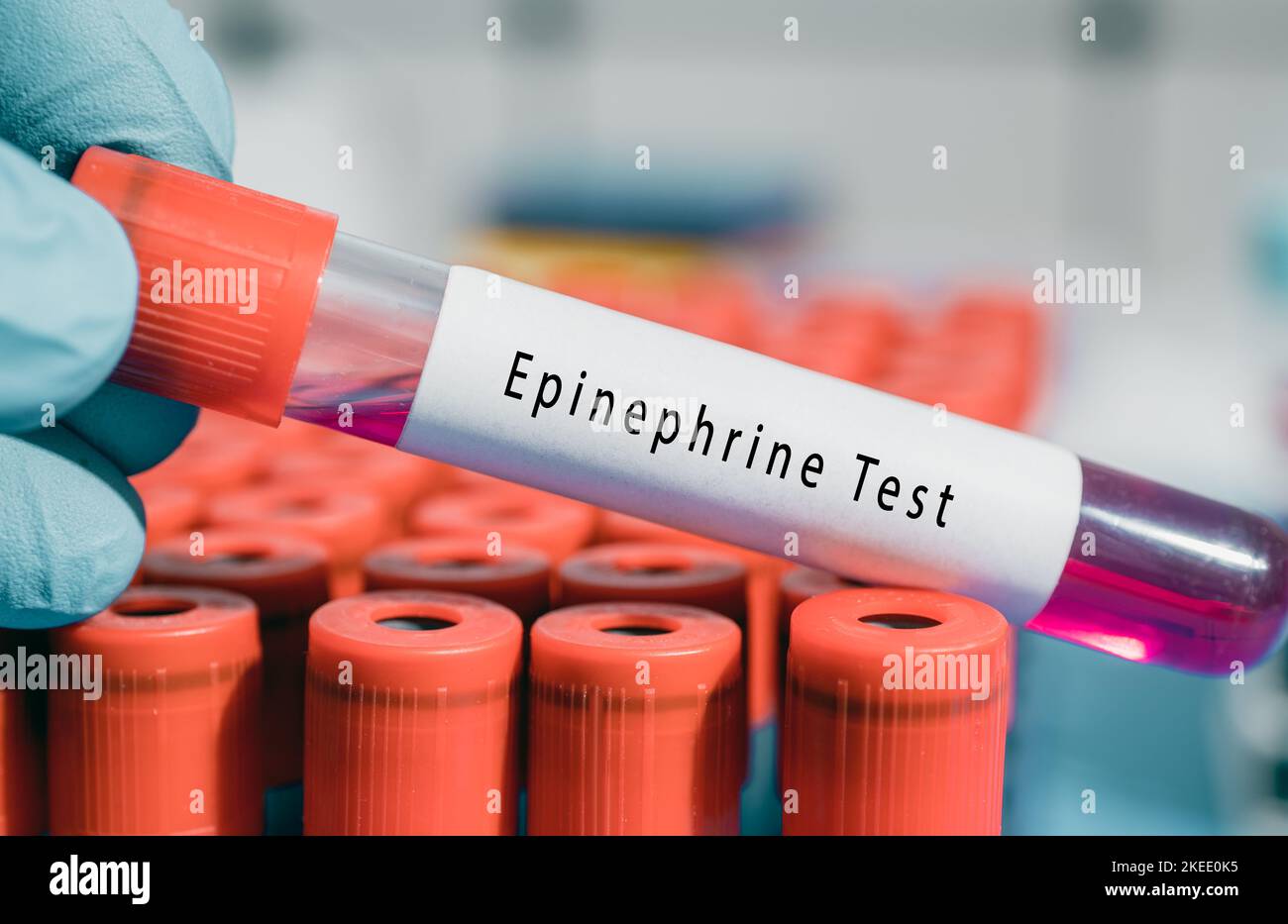 Adrenal glands Epinephrine Test Increases heart rate, oxygen intake and
