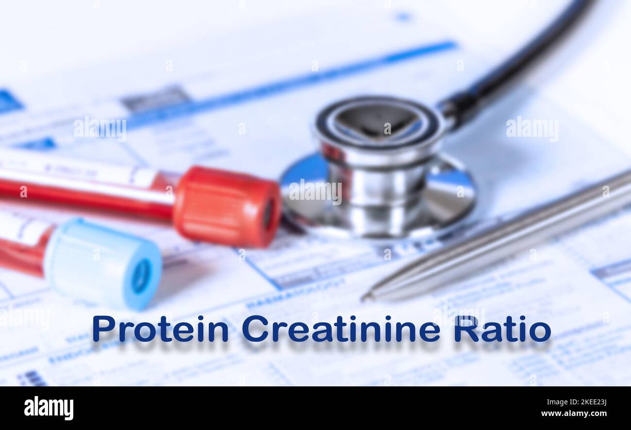 Protein creatinine ratio test, conceptual image Stock Photo Alamy