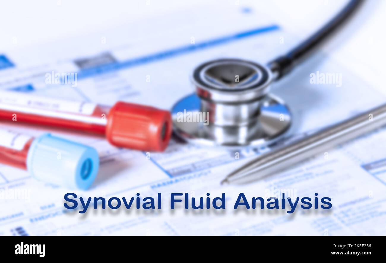 Synovial fluid analysis test, conceptual image Stock Photo Alamy