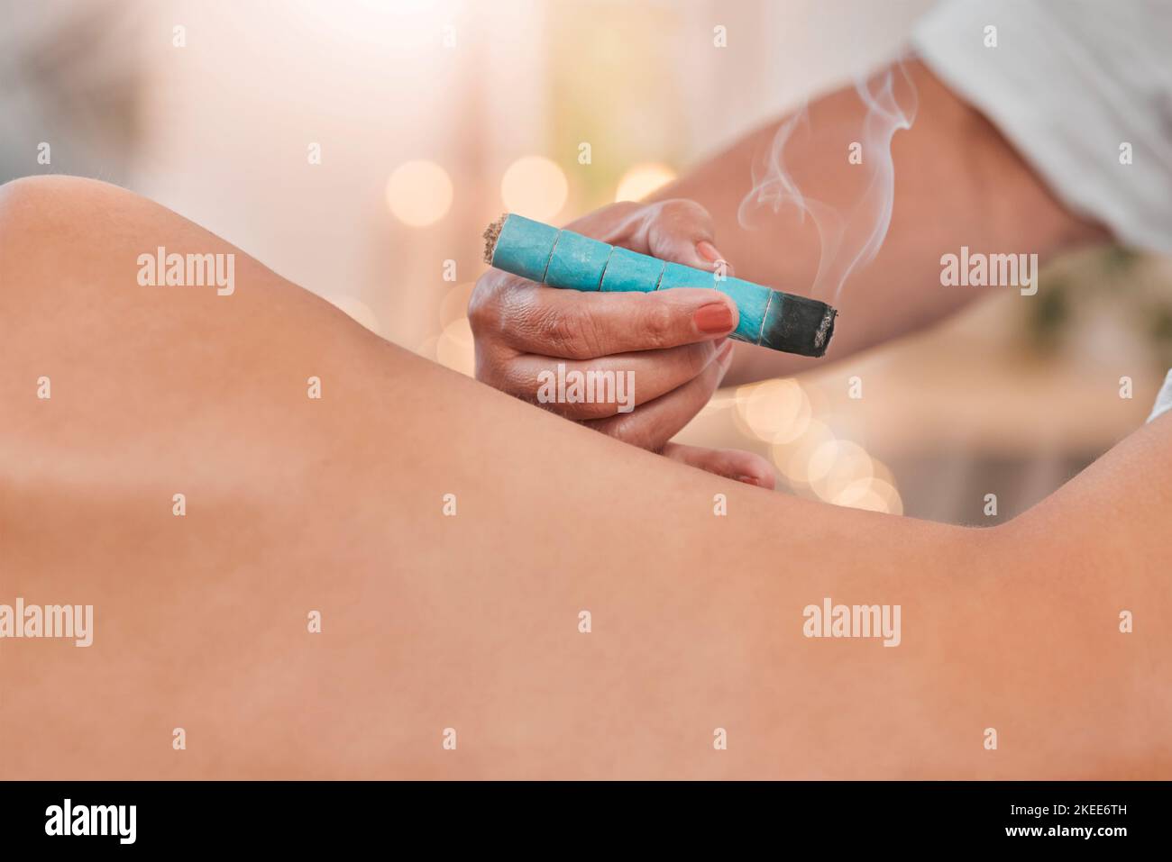 Spa, wellness and moxibustion treatment for body for health, traditional healing and stress relief. Physical therapy, alternative medicine and massage Stock Photo