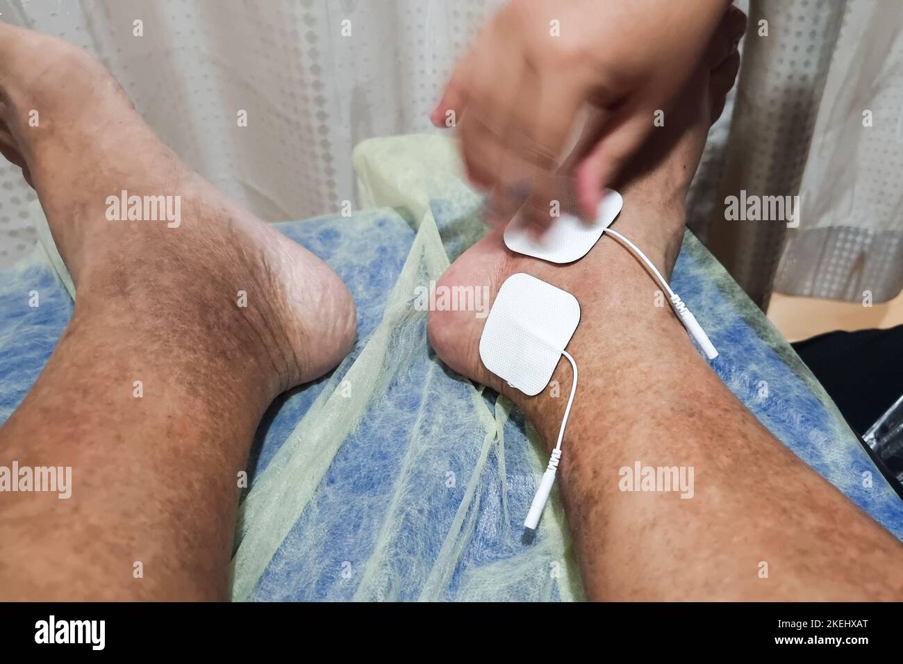 Therapist attaching sticky electrodes onto patient's foot to undergo the interferential treatment Stock Photo