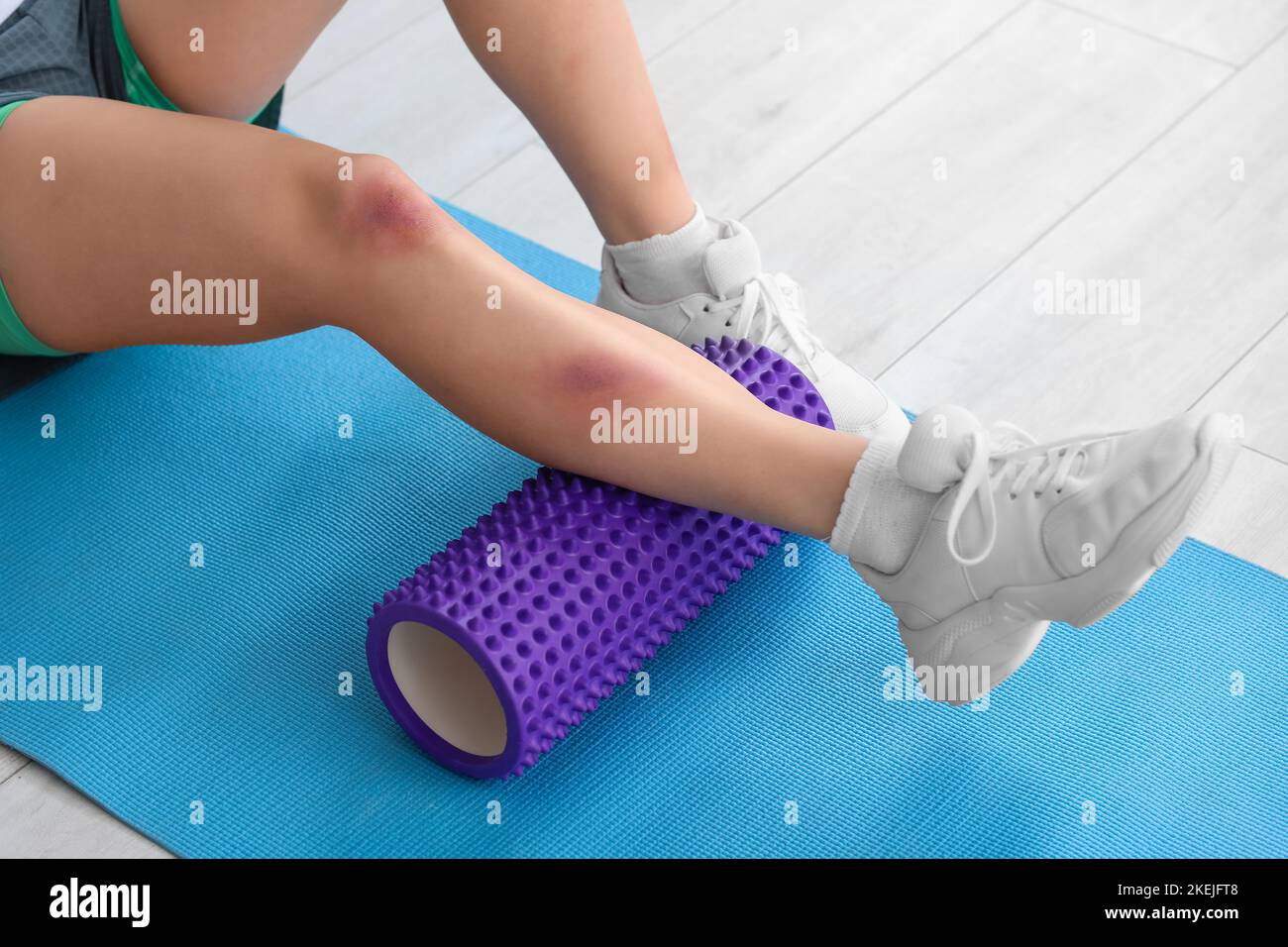 Woman bruise leg domestic violence hires stock photography and images