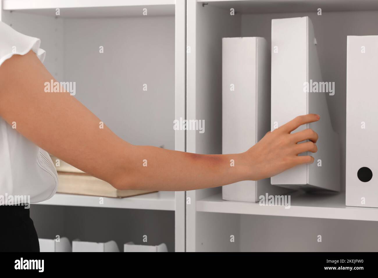 Young woman with bruised arm taking folder from shelf in office ...