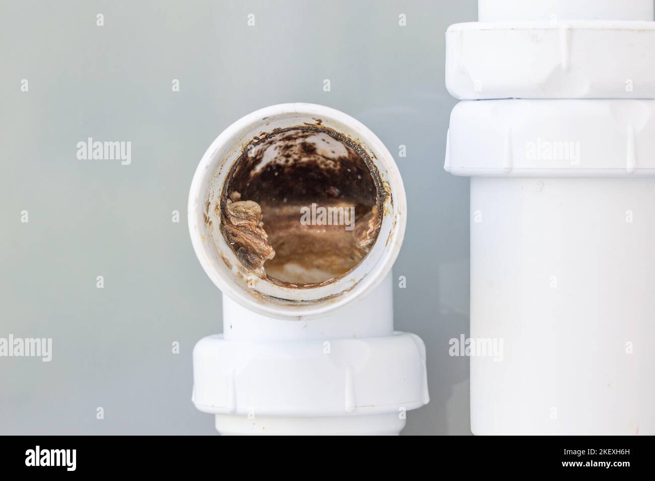 Blockage of pipe. Sink in bath and kitchen. Dirty tube. Water and