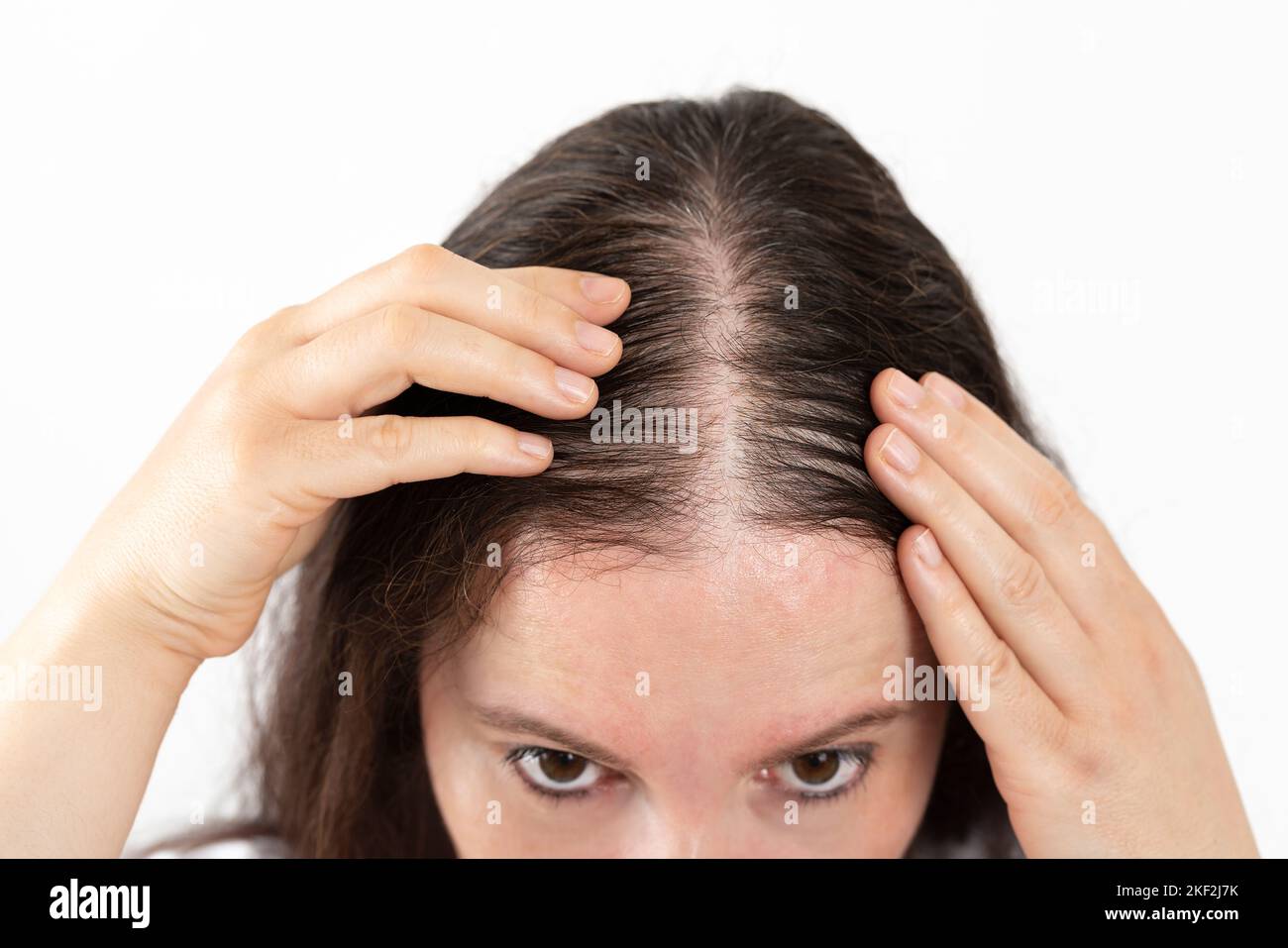 Close-up of woman controls hair loss and little volume with fine hair against white background Stock Photo