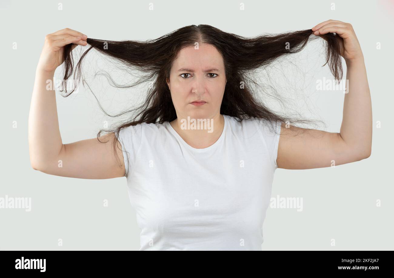 The woman controls hair loss and little volume looking at the camera Stock Photo