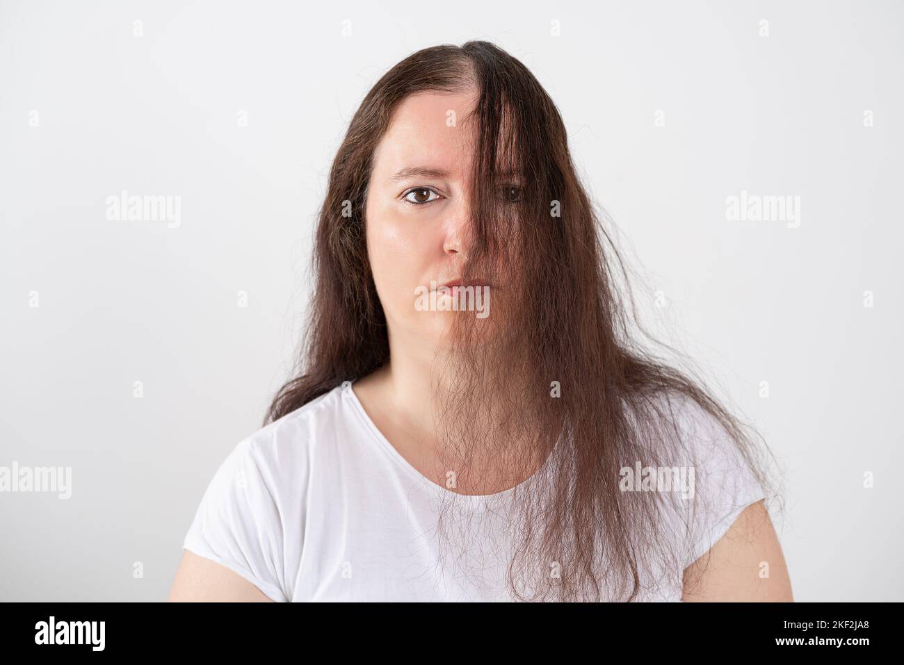 Upset middle aged woman with alopecia looking at camera, hair loss concept Stock Photo