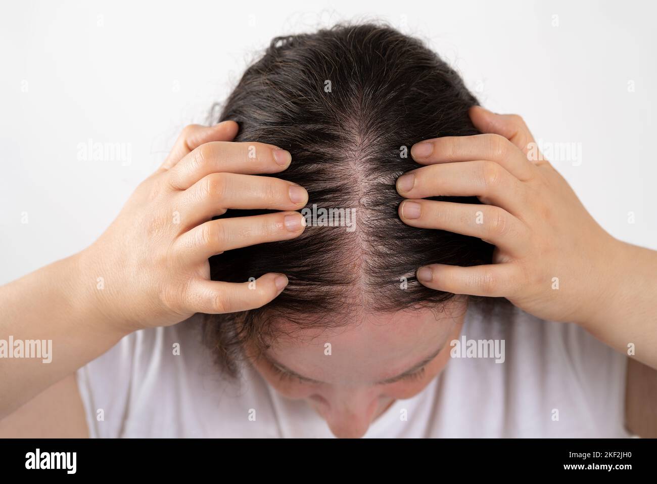 Close-up of woman controls hair loss and little volume with fine hair against a white background because of the sun Stock Photo