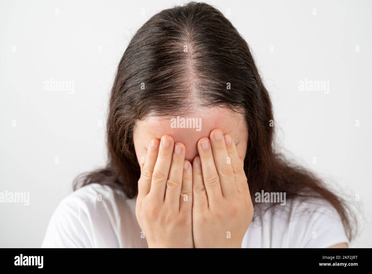 Close up of hair loss woman stressed and crying over rapid hair loss against white background Stock Photo