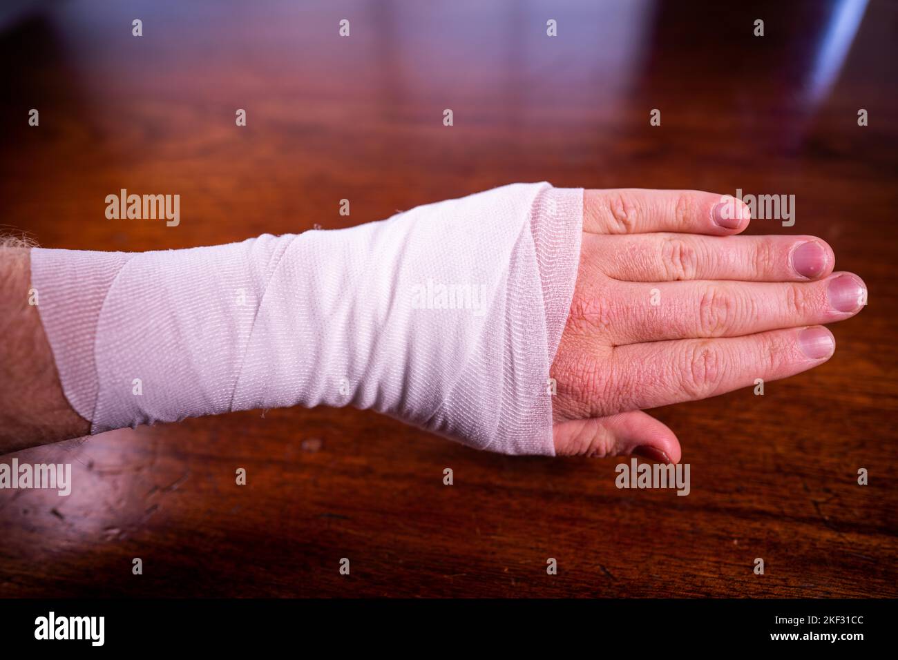 bandaging an arm of a patient in a hospital in care Stock Photo Alamy