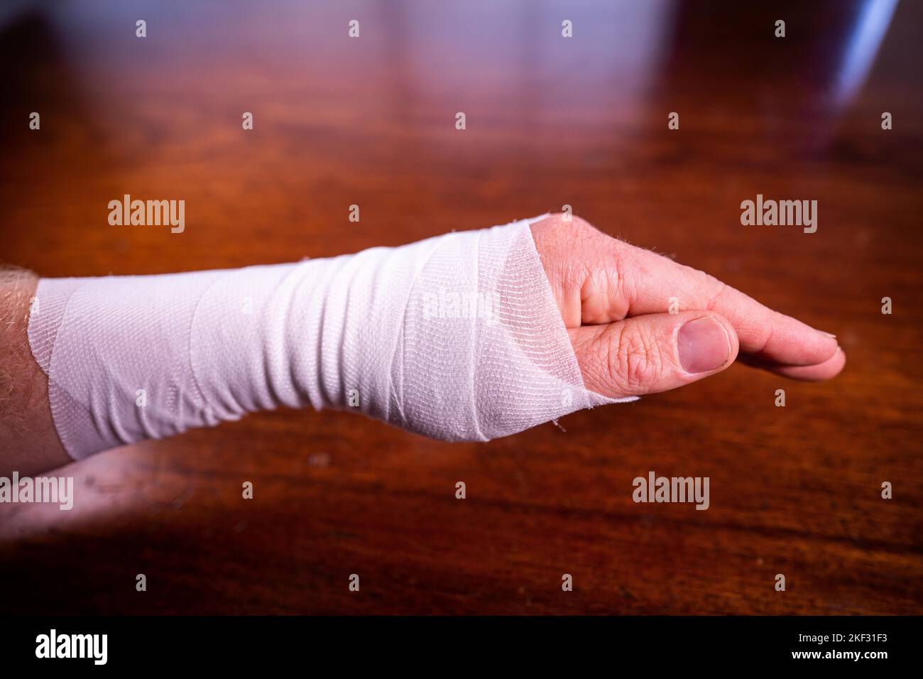 bandaging an arm from a snake bite in australia Stock Photo Alamy