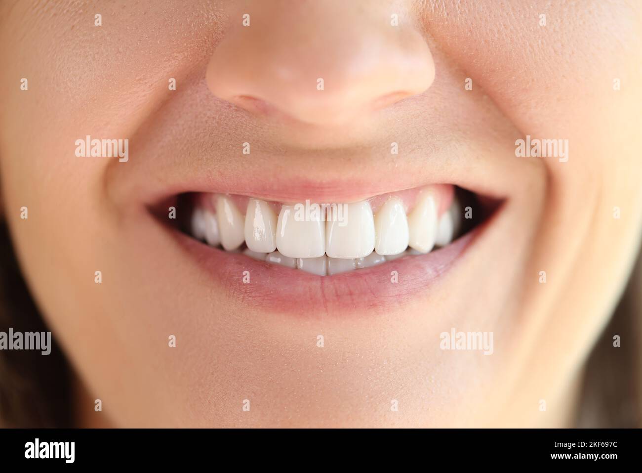 Beautiful smile with great healthy white teeth close up. Stock Photo