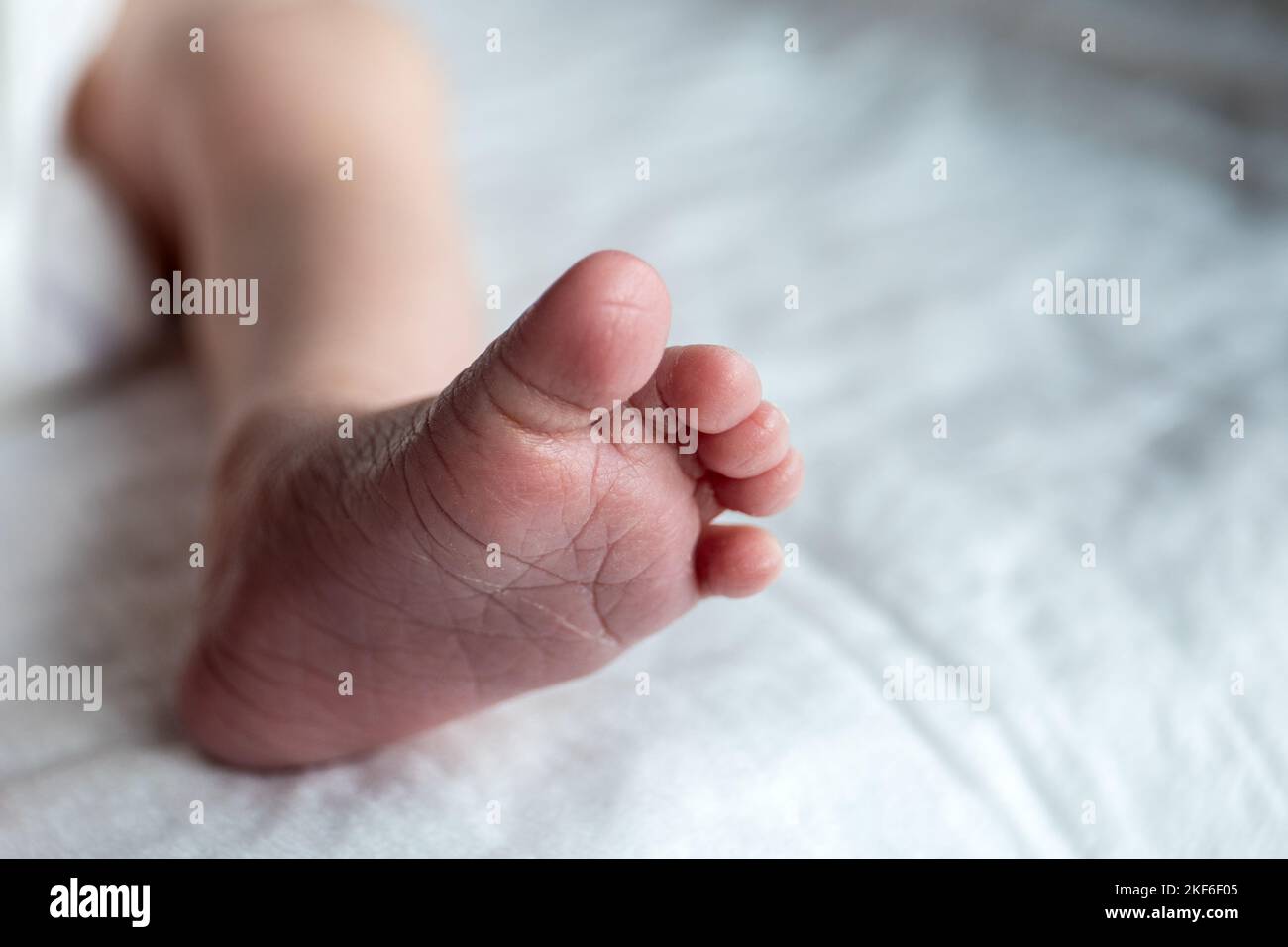 Newborn foot. Little fingers, peeling skin. White background Stock