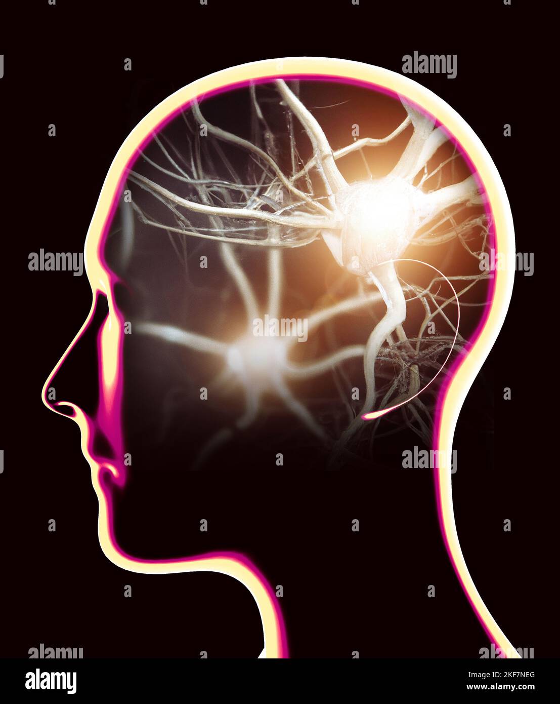 Section of a brain seen in profile. Degenerative diseases, Parkinson, synapses, neurons, Alzheimers.  Silhouette of a man face on a black background Stock Photo