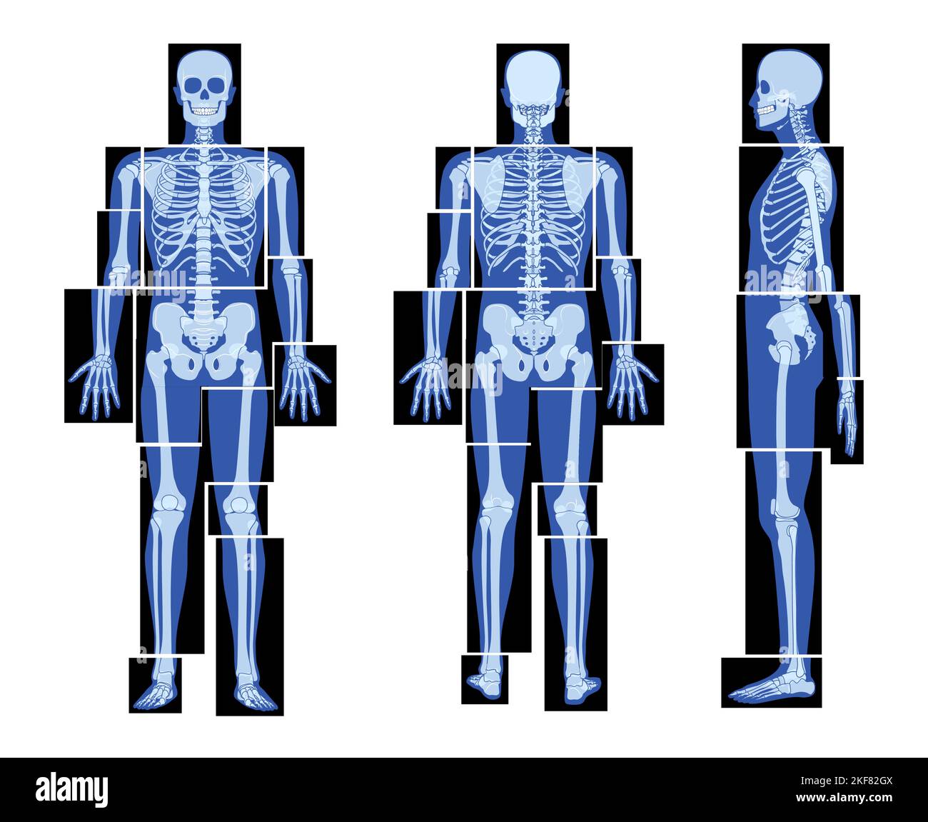 Set of X-Ray Skeleton Human body parts - hands, legs, chest, head, vertebra, pelvis, Bones adult people roentgen front back side view. 3D realistic flat concept Vector illustration of medical anatomy Stock Vector