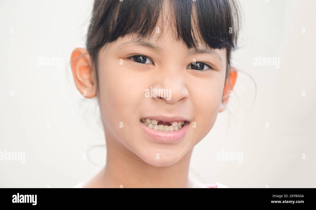lost milk teeth - lost baby tooth , smile face of a child girl baby