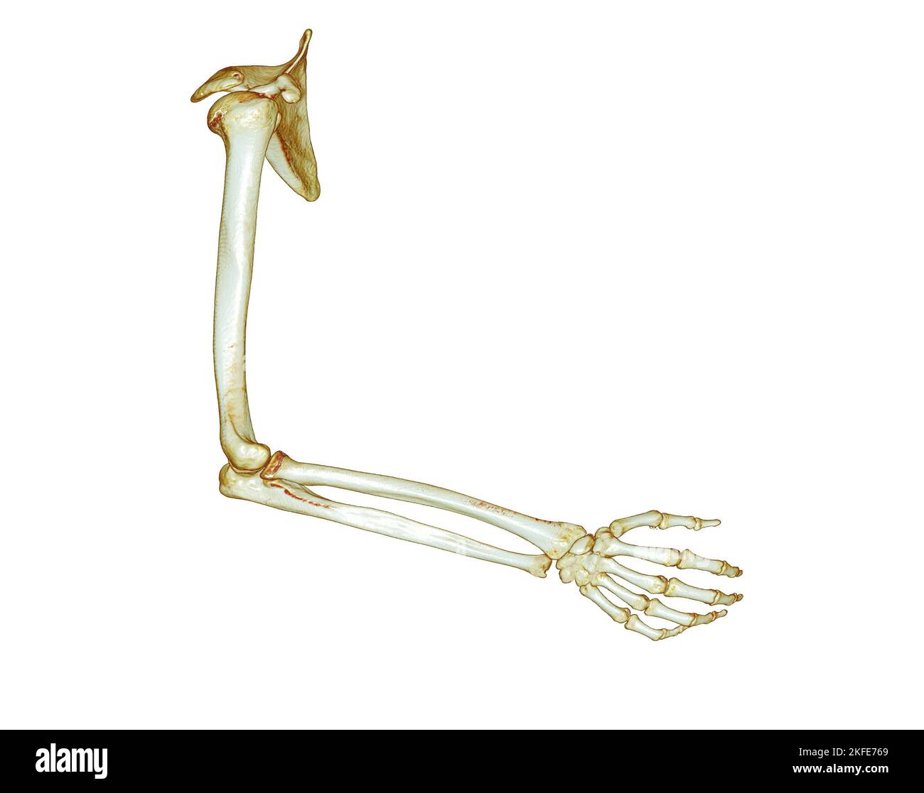 CT SCAN of Arm 3D rendering isolated on white background .Clipping path. Stock Photo