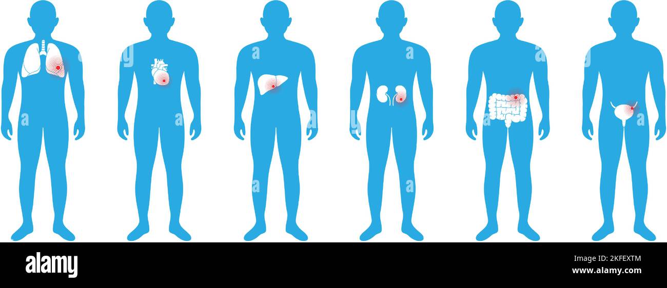 Male body with internal organs pains. Lungs, heart, liver, kidneys, intestines, bladder. Donor medical poster. Different body ache icons Stock Vector