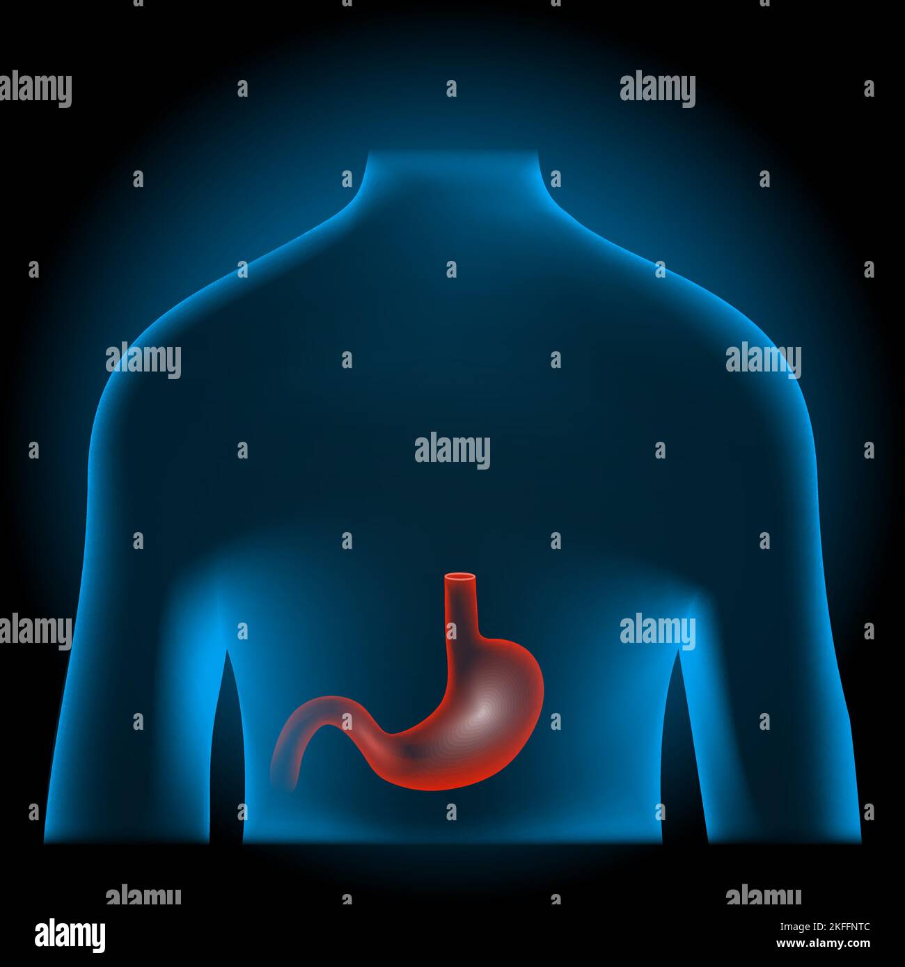 stomach ache. Gastrointestinal tract. Digestive system. Red stomach into x-ray blue realistic torso. Human silhouette on dark background. Human body Stock Vector