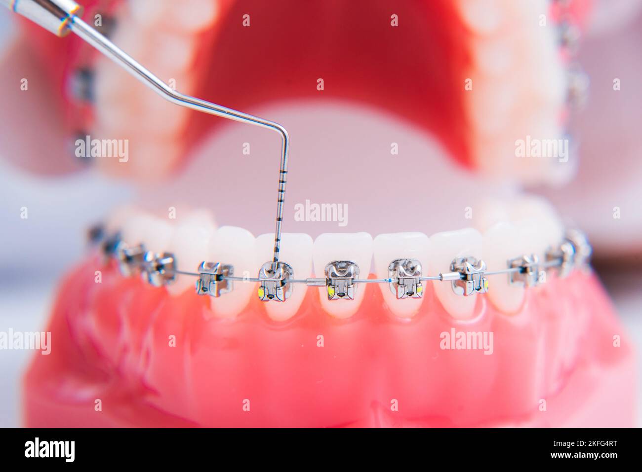 macro photography shows how the braces are arranged Stock Photo - Alamy