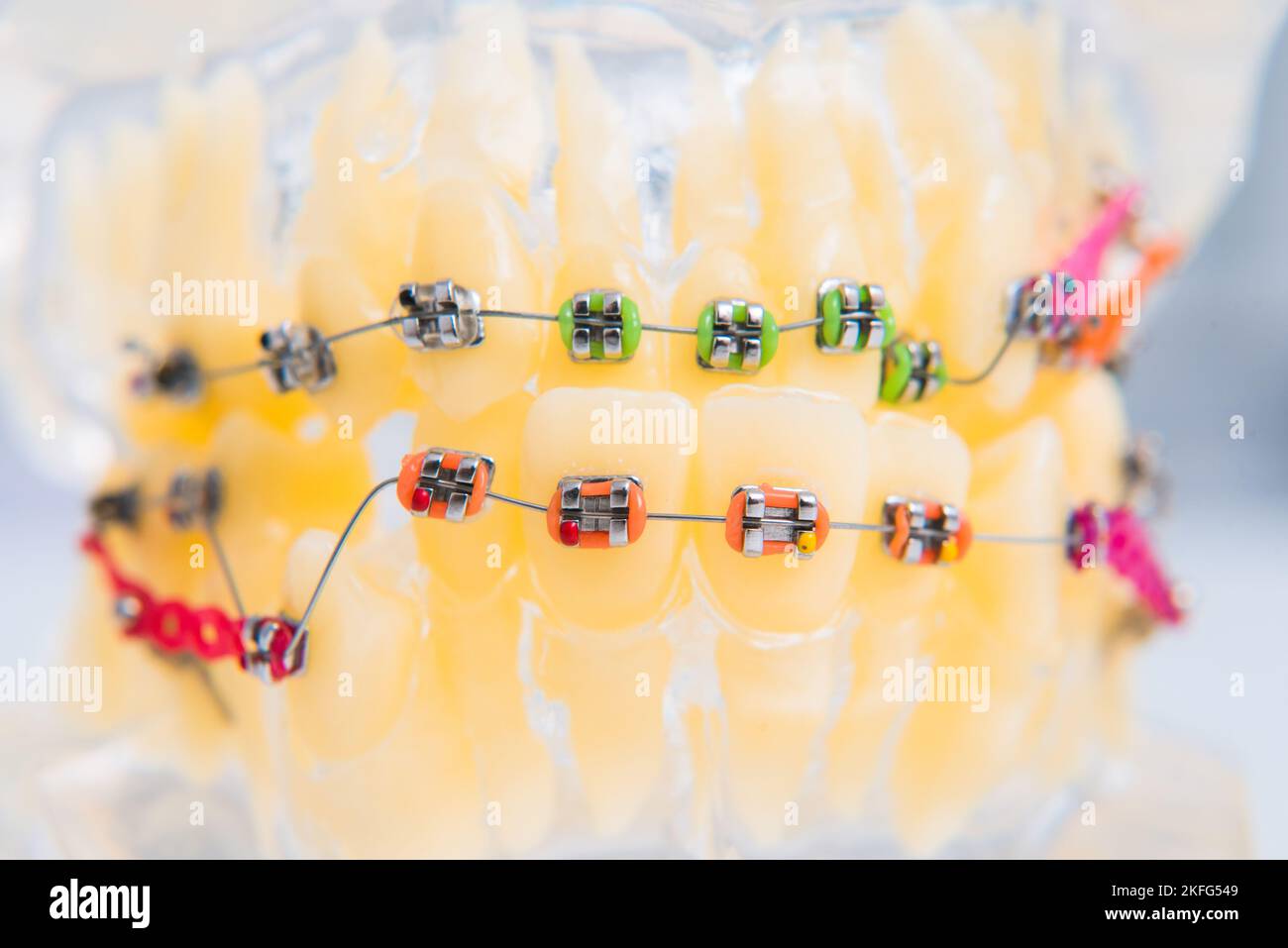 macro photography shows how the braces are arranged Stock Photo - Alamy