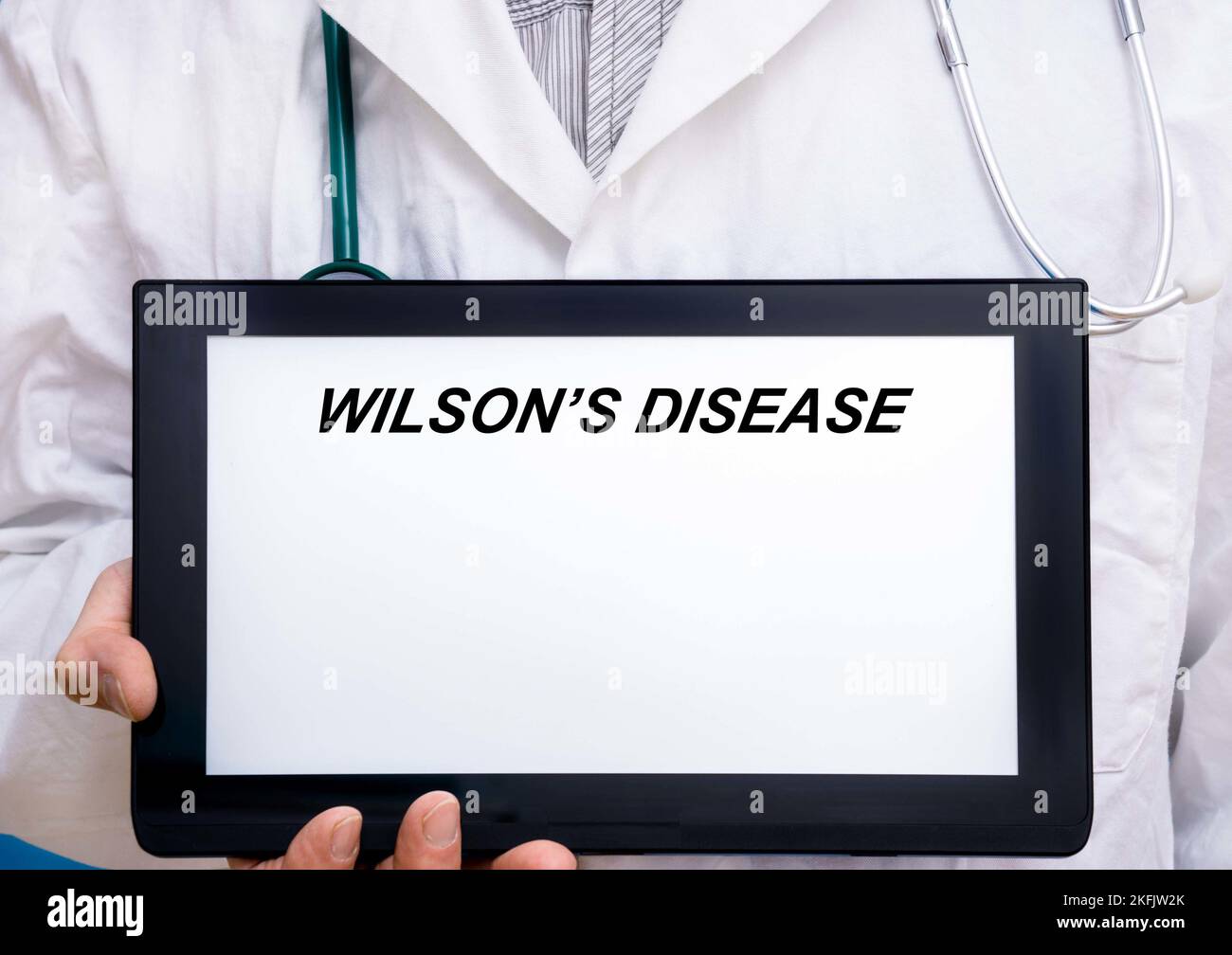 Wilson's disease hi-res stock photography and images - Alamy