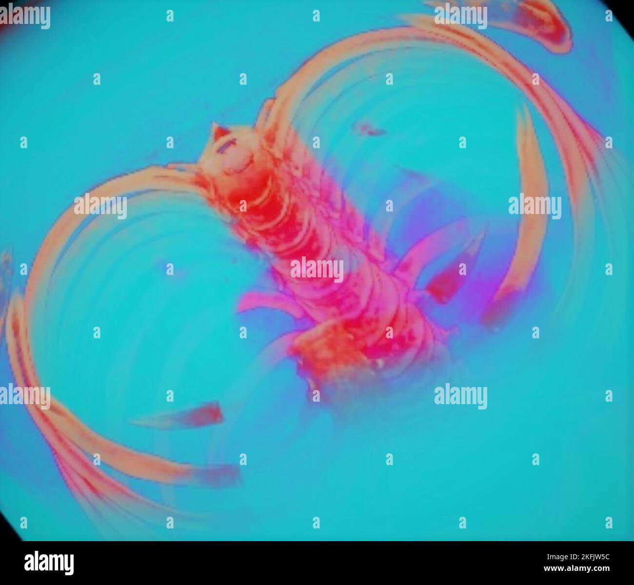 Rib cage and spine, 3D CT scan Stock Photo Alamy