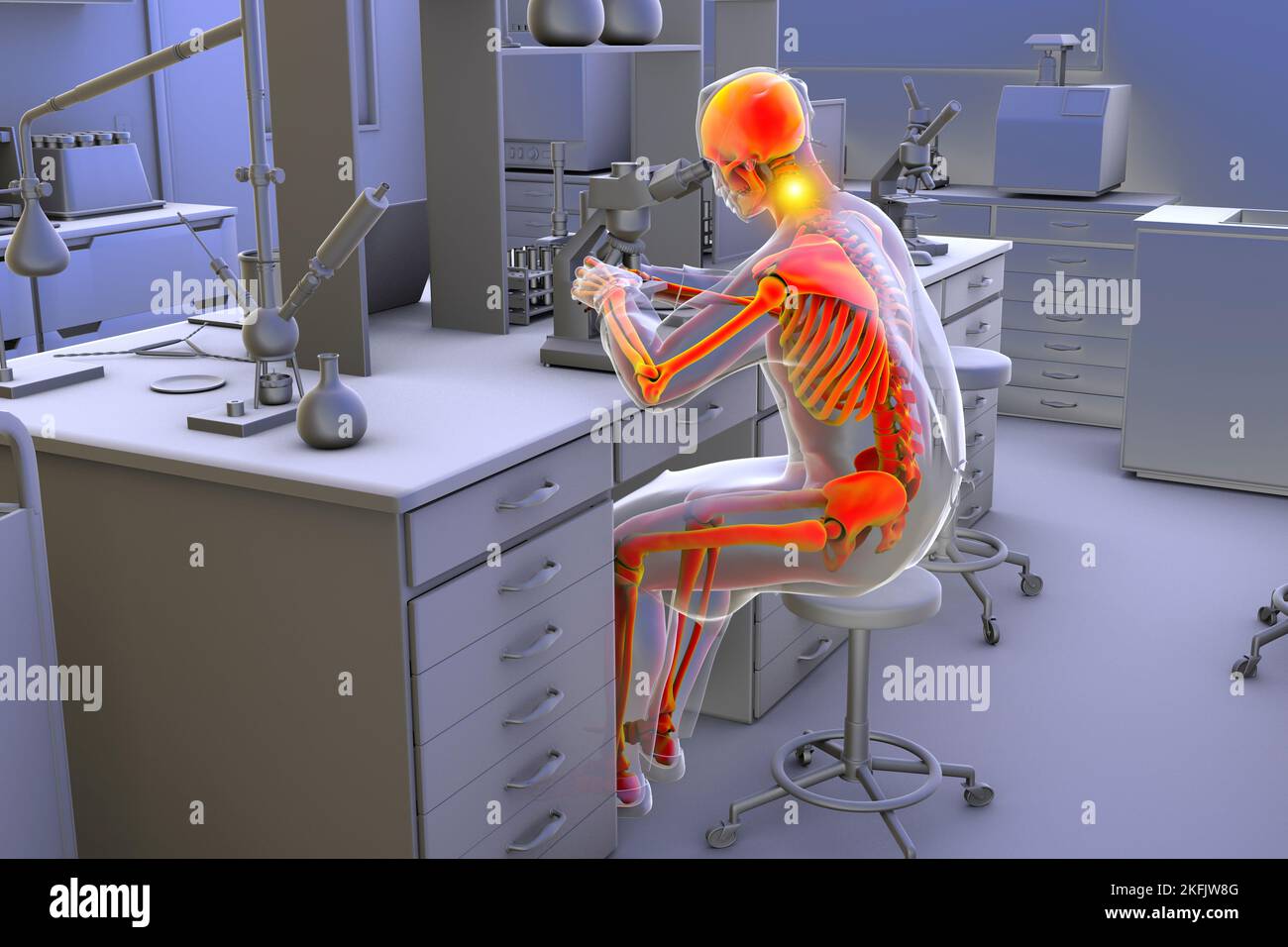 Musculoskeletal disorders in laboratory workers, illustration Stock