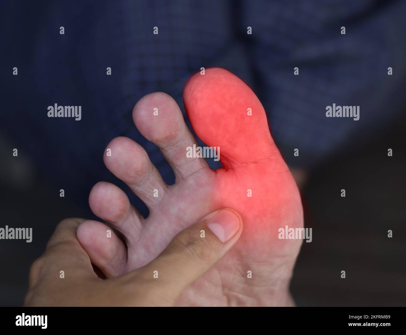Inflammation in the big toe of Asian man. Concept of foot joint pain, arthritis, stumble