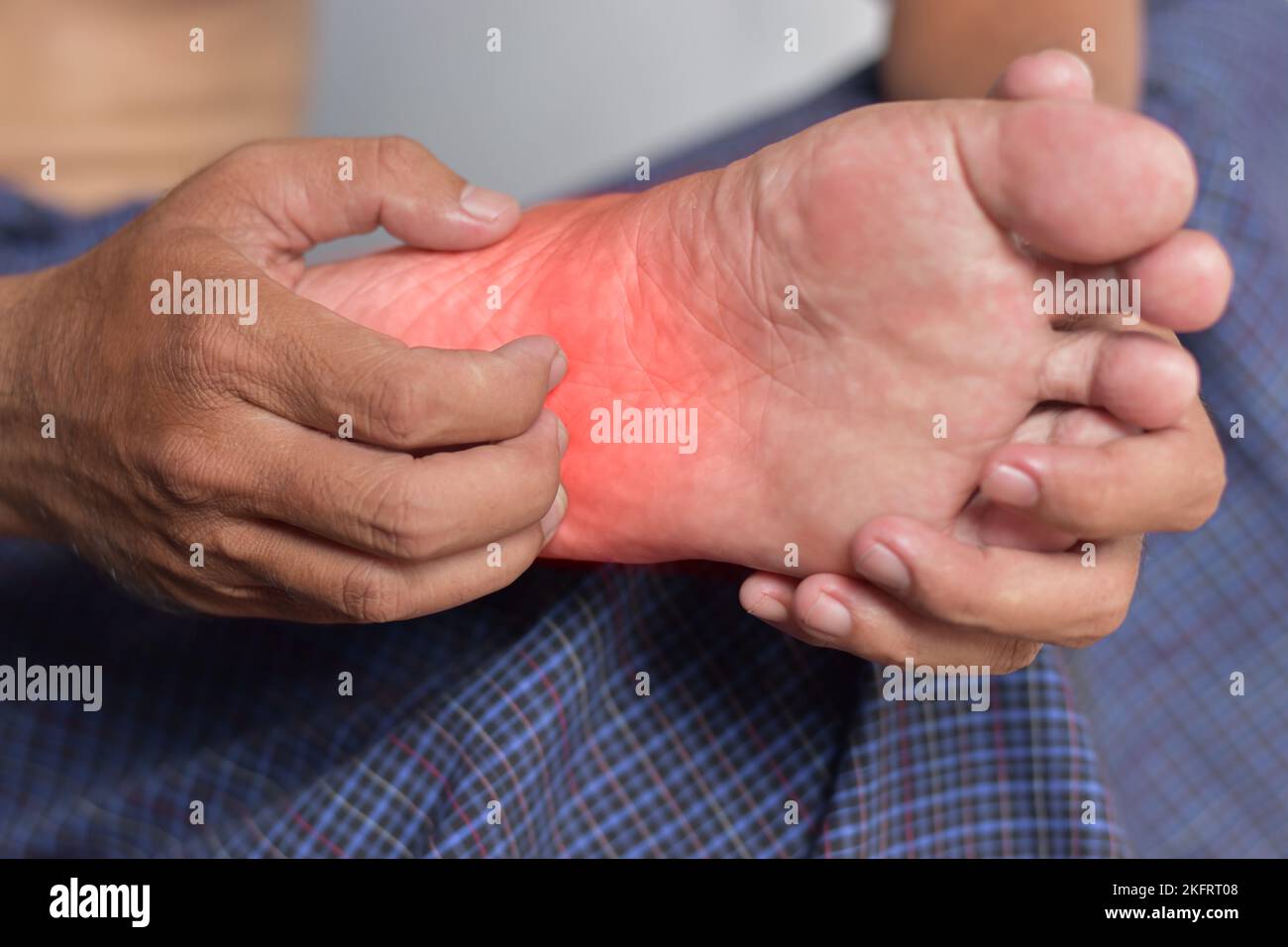 Itchy foot skin of Asian young man. Concept of skin diseases such as scabies, fungal infection, rash, allergy, etc. Stock Photo