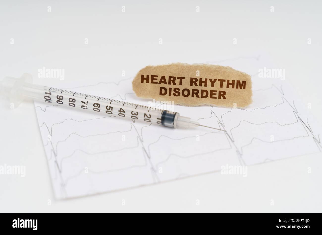 Medicine and health concept. On the table is a cardiogram, a syringe and paper with the inscription - heart rhythm disorder Stock Photo
