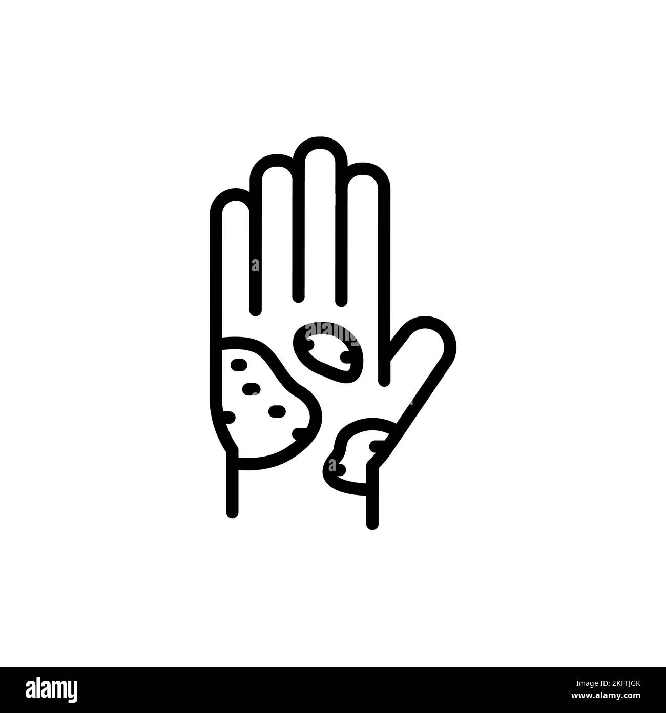 Skin eczema Black and White Stock Photos & Images Alamy