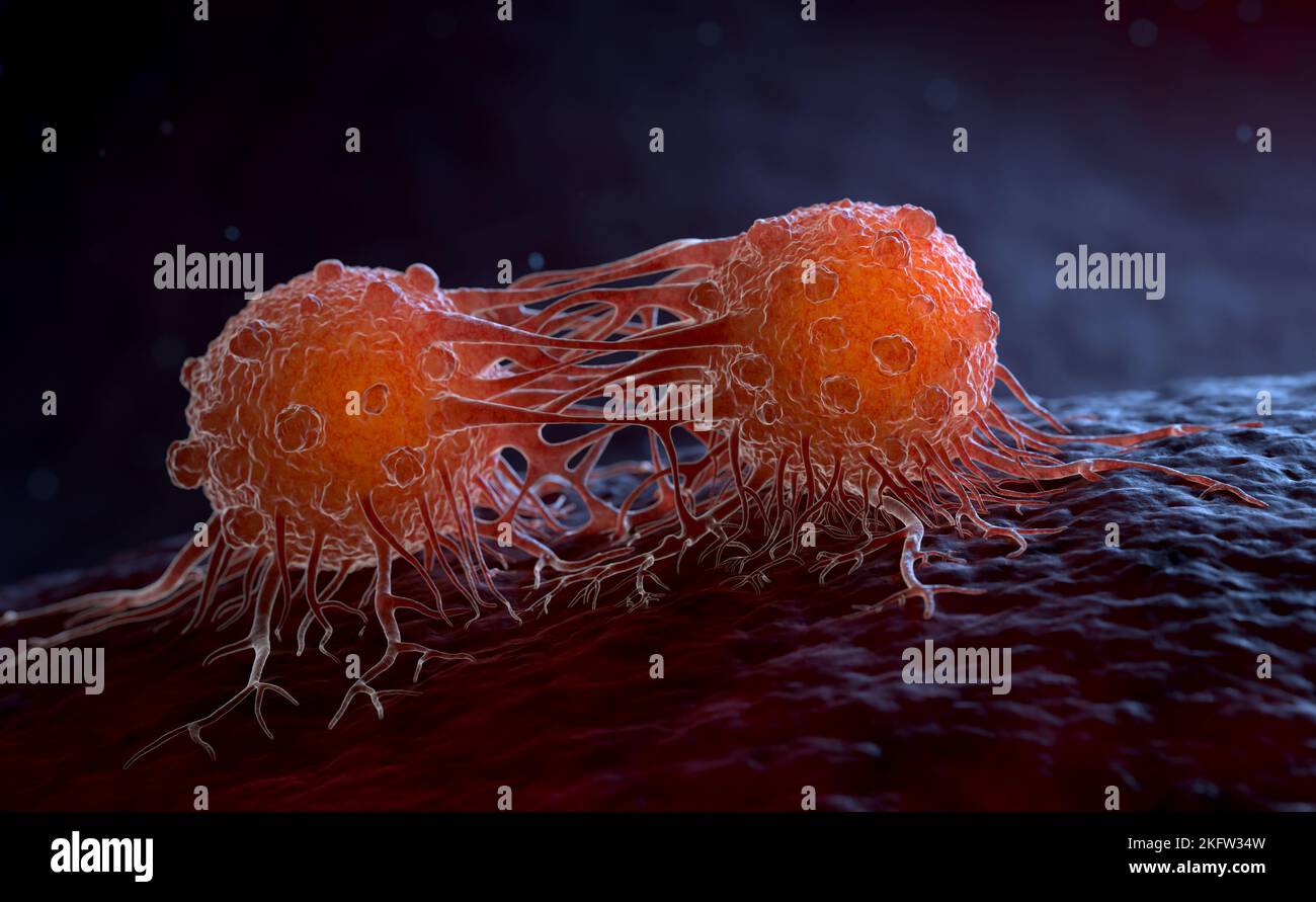 Cancer cells can migrate to other body tissues or organs building metastasis. 3D illustration Stock Photo
