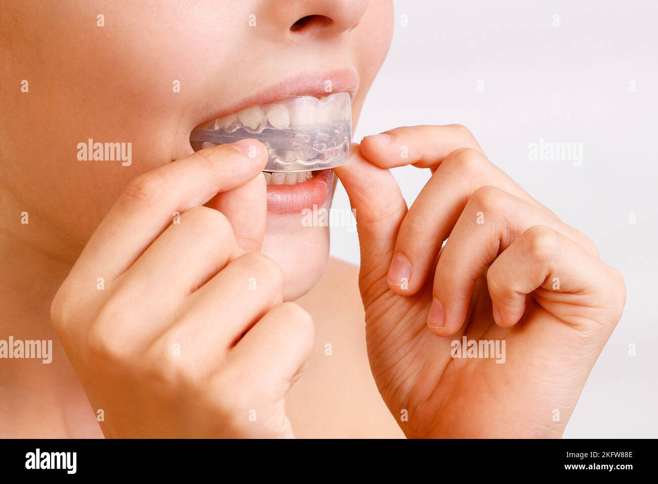 Boy is wearing orthodontic silicone trainer or nightguard case Stock