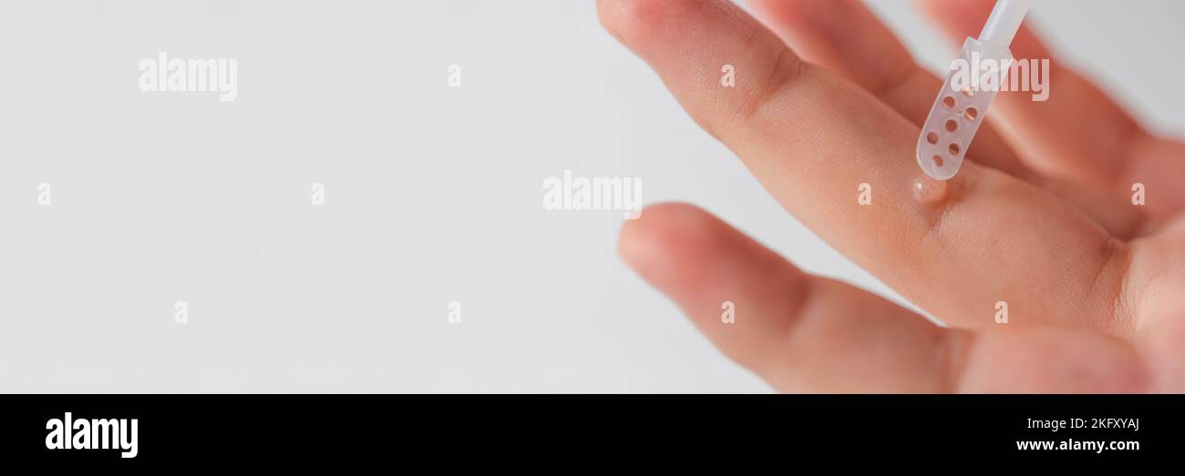 Apply the medicine to the wart with a special spatula or brush. Wart on