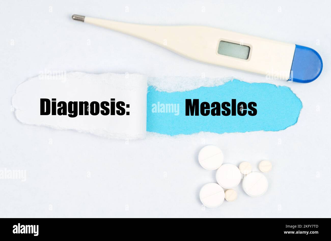Medical diagnosis. A gap is made in the middle of the white sheet, inside of which there is an inscription - Measles on a blue background. On the shee Stock Photo